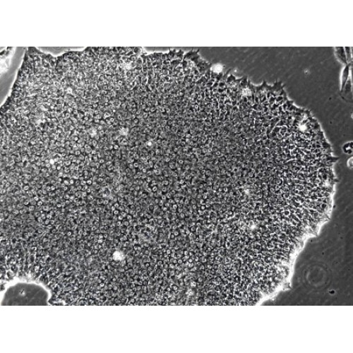 Human iPS Cell Line (SOD1 mutation, A4V)